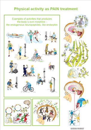 Physical activity as PAIN treatment poster
