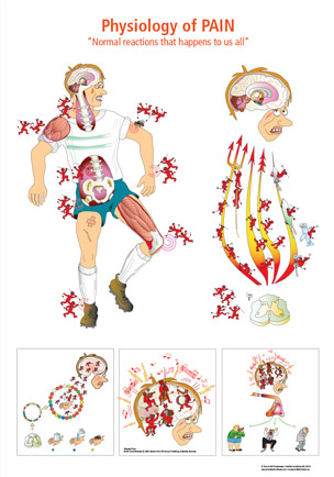 Physiology of pain poster