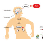 Picture 4 – Pain can be very stressful