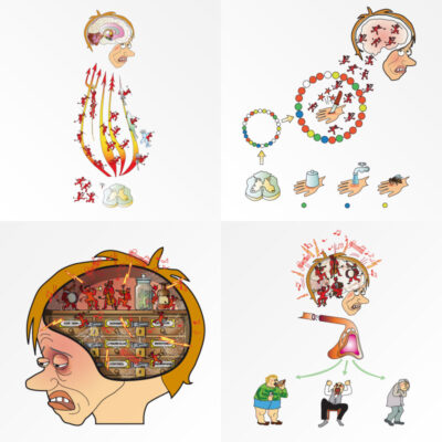 Pain Physiology - Four images