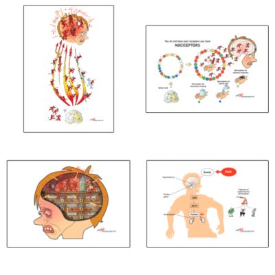 Physiology of Pain – Four images – digital download